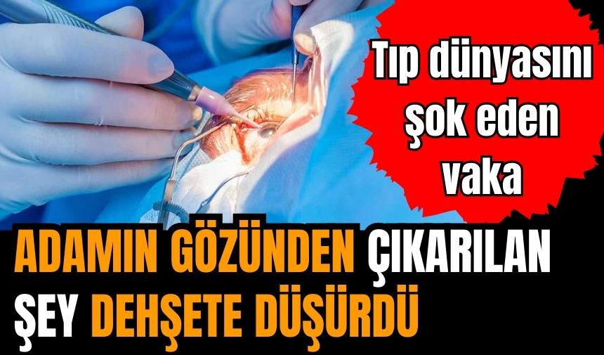 Gözünden çıkartılan şey doktorları şok etti