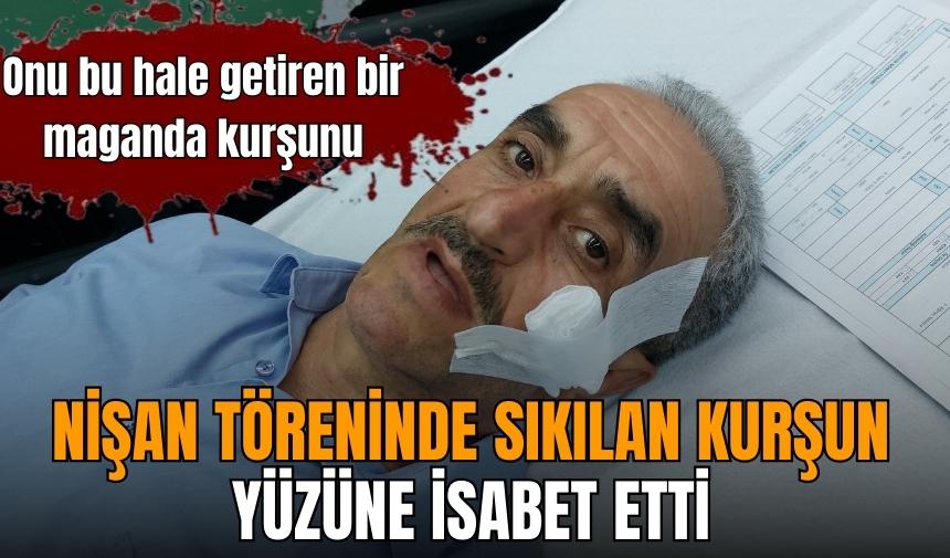 Nişan günü yüzünden vuruldu