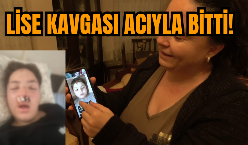 Lise kavgasında 14 yaşındaki öğrencinin burnu kırıldı