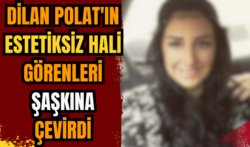 Dilan Polat'ın estetiksiz hali görenleri şaşkına çevirdi!