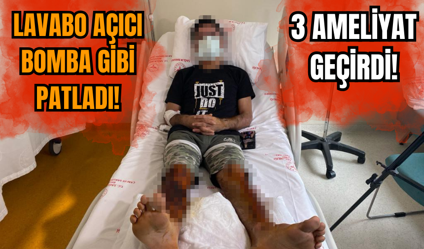 Lavabo açıcı bomba gibi patladı: Her yeri yandı 3 ameliyat geçirdi!