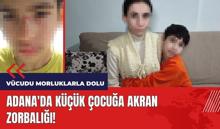 Adana'da küçük çocuğa akran zorbalığı: Vücudu morluklarla dolu