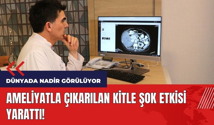 Ameliyatla çıkarılan kitle şok etkisi yarattı