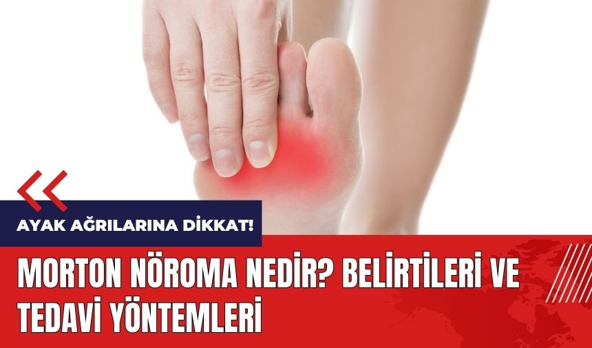 Ayak ağrılarına dikkat! Morton nöroma nedir? Morton nöroma belirtileri ve tedavi yöntemleri