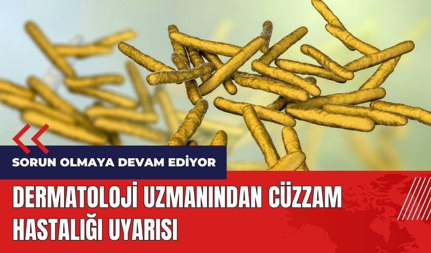 Dermatoloji uzmanından Cüzzam hastalığı uyarısı