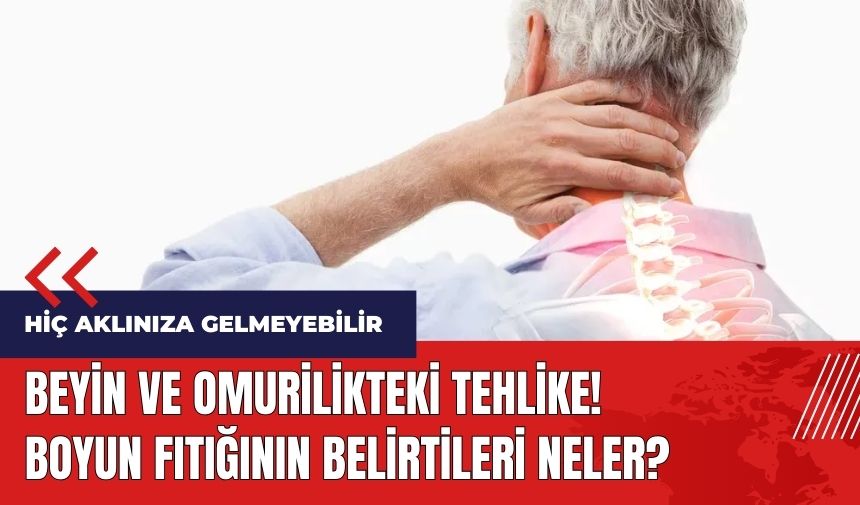 Beyin ve omurilikteki tehlike! Boyun fıtığının belirtileri neler?