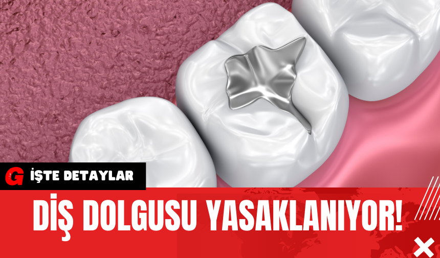 Diş Dolgusu Yasaklanıyor!