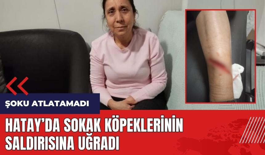 Hatay'da sokak köpeklerinin saldırısına uğradı