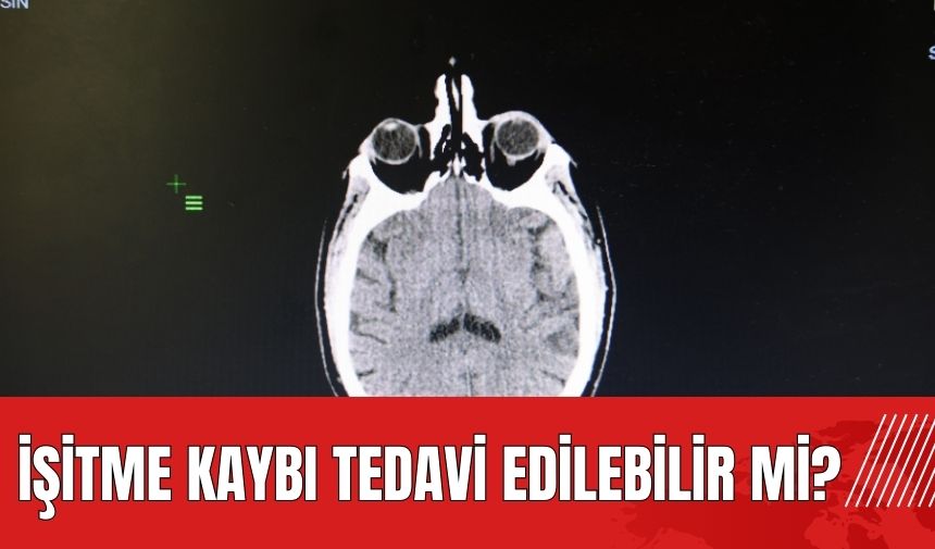 İşitme kaybı tedavi edilebilir mi?