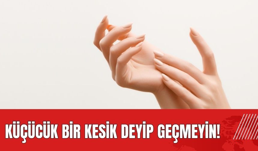 Küçücük bir kesik deyip geçmeyin! Tehlikesi büyük olabilir