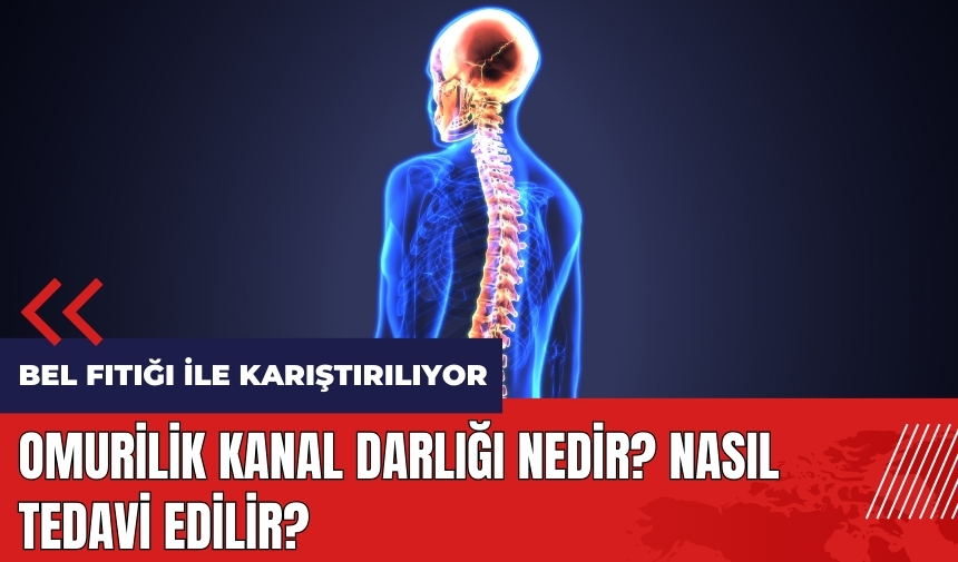 Omurilik Kanal Darlığı nedir? Nasıl tedavi edilir?