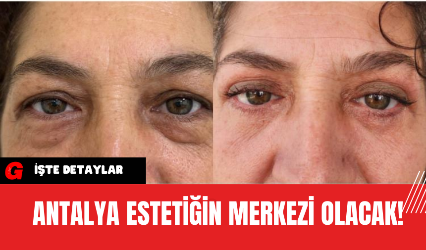 Antalya Estetiğin Merkezi Olacak!