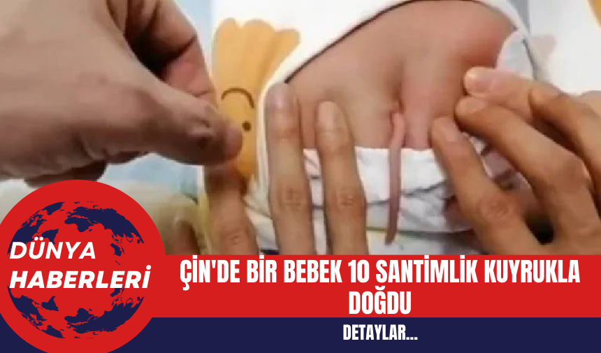 Çin'de Bir Bebek 10 Santimlik Kuyrukla Doğdu