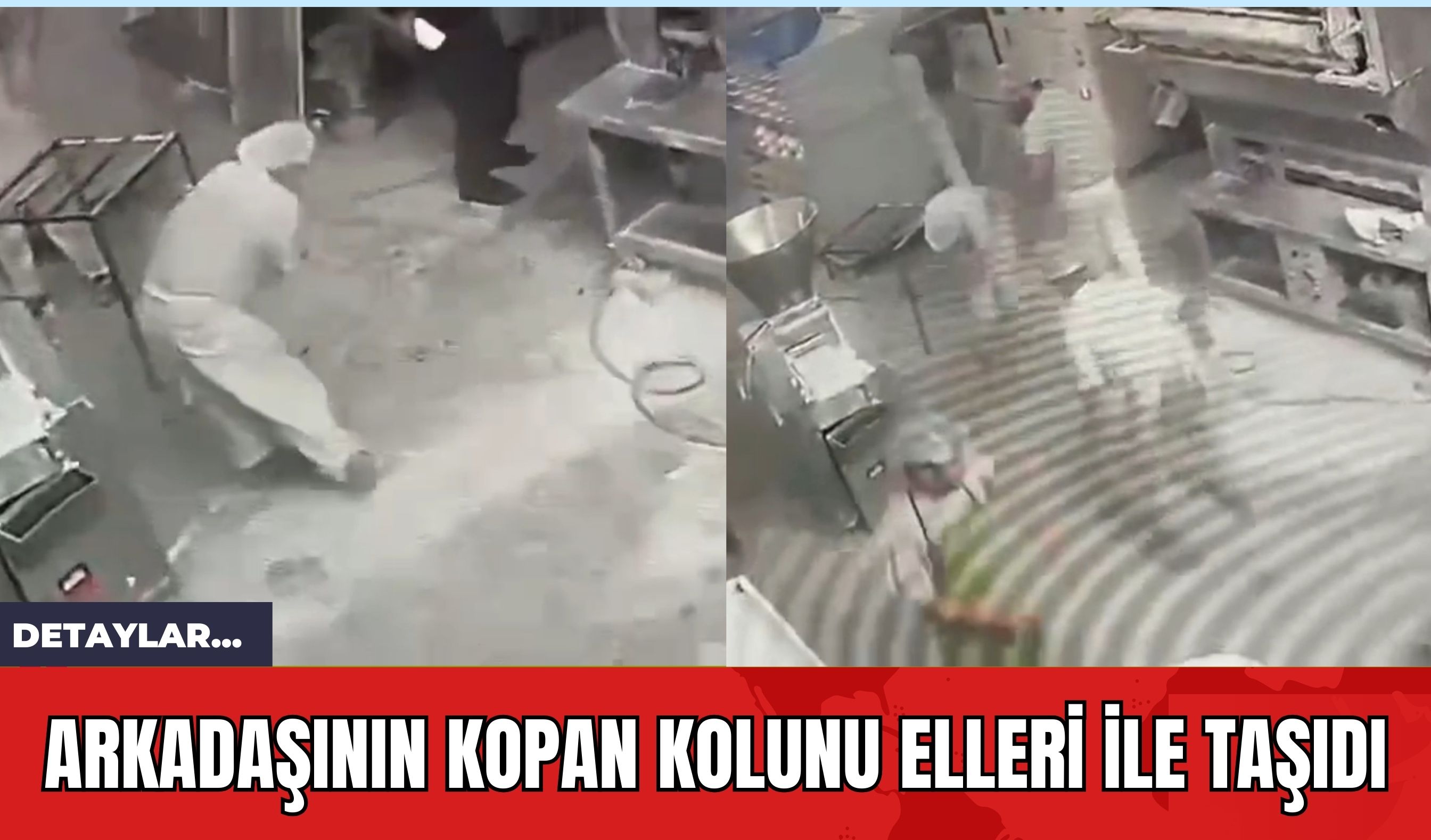 Arkadaşının Kopan Kolunu Elleri İle Taşıdı