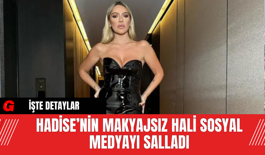 Hadise’nin Makyajsız Hali Sosyal Medyayı Salladı