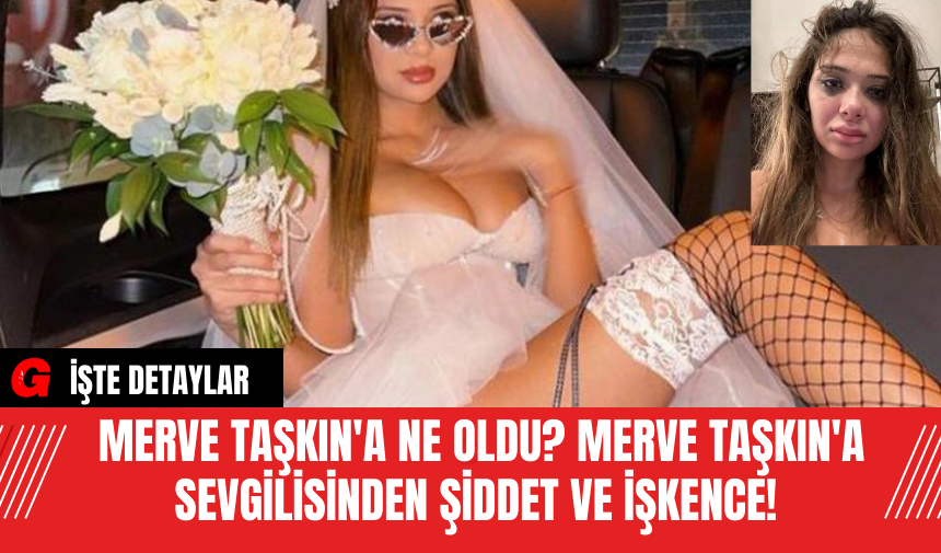 Merve Taşkın'a Ne Oldu? Merve Taşkın'a Sevgilisinden Şiddet ve İşkence!