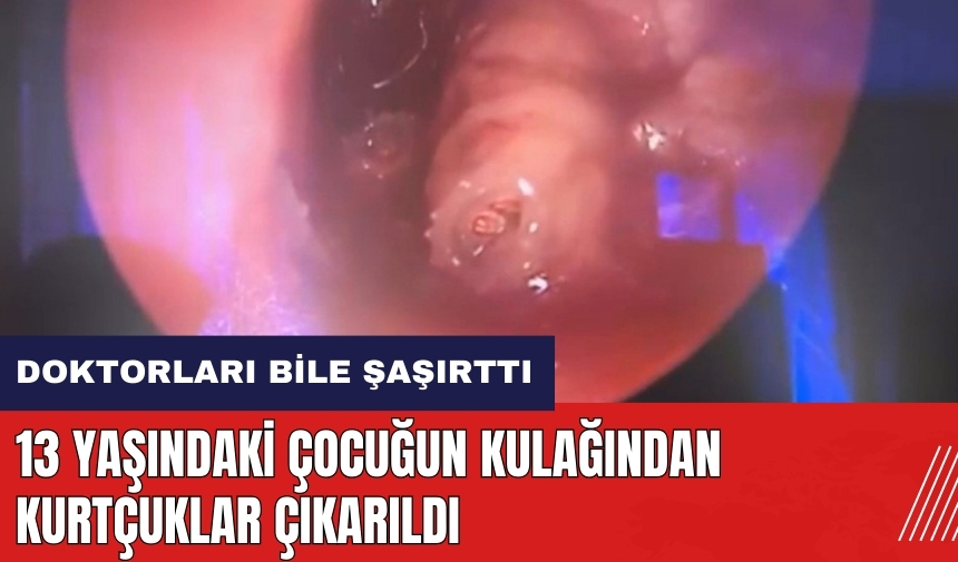 13 yaşındaki çocuğun kulağından kurtçuklar çıkarıldı