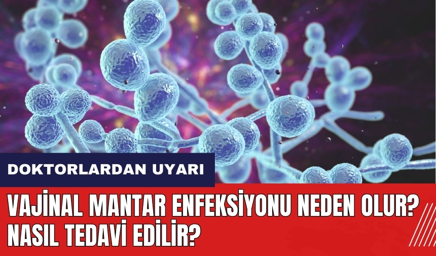 Vajinal Mantar Enfeksiyonu neden olur? Nasıl tedavi edilir?