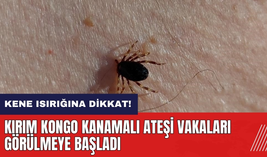 Kene ısırığına dikkat! Kırım Kongo Kanamalı Ateşi vakaları görülmeye başladı