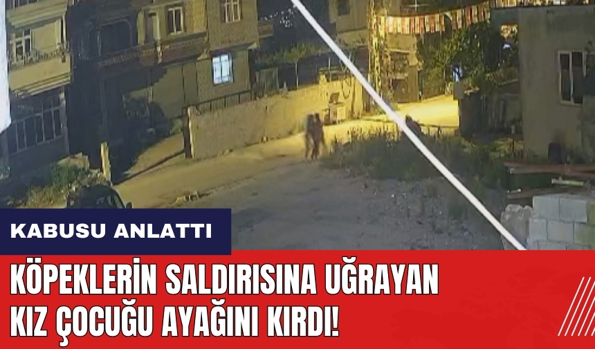 Köpeklerin saldırısına uğrayan kız çocuğu ayağını kırdı!