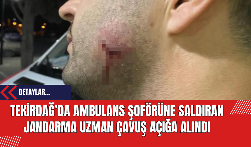 Uzman Çavuş Ambulans Şoförünü Isırdı!