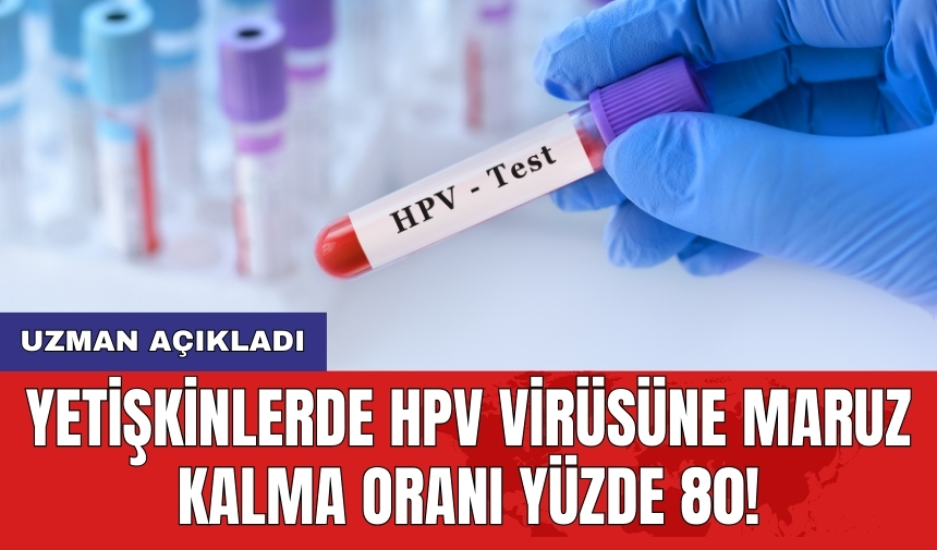 Uzman açıkladı: Yetişkinlerde HPV virüsüne maruz kalma oranı yüzde 80!