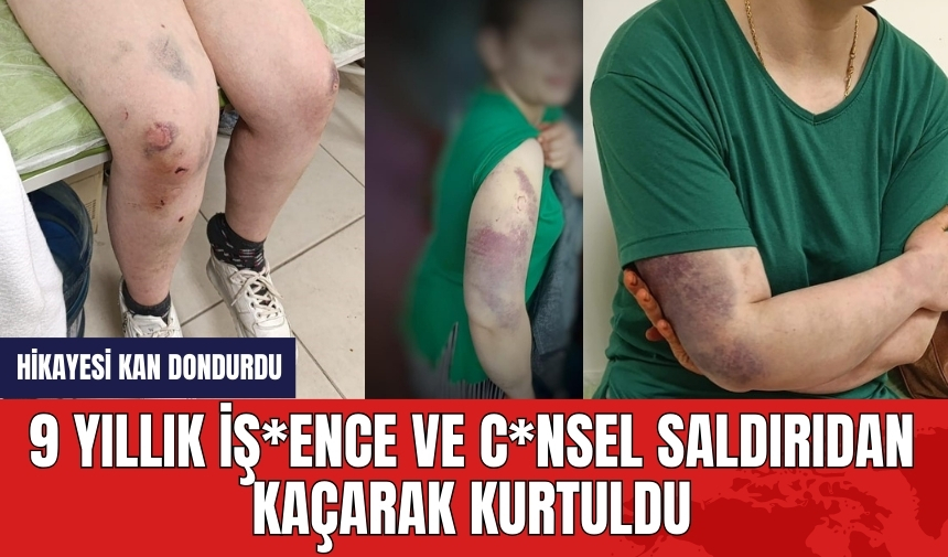 9 Yıllık iş*ence ve c*nsel saldırıdan kaçarak kurtuldu