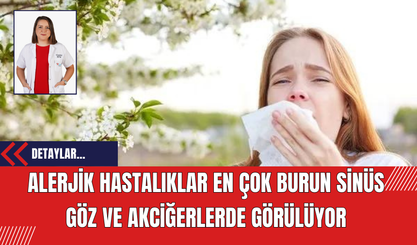 Alerjik hastalıklar en çok burun sinüs göz ve akciğerlerde görülüyor