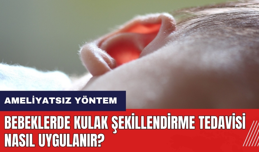 Bebeklerde kulak şekillendirme tedavisi nasıl uygulanır?