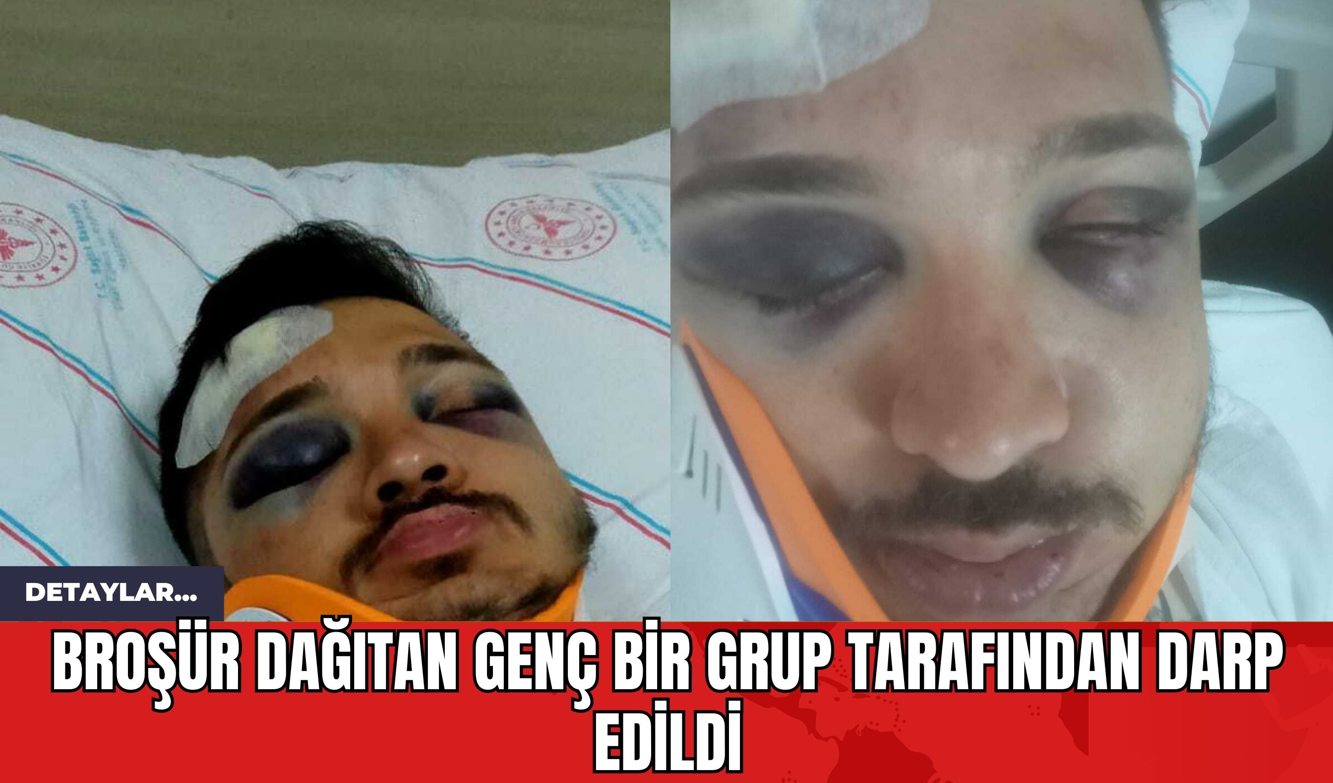 Broşür Dağıtan Genç Bir Grup Tarafından Darp Edildi