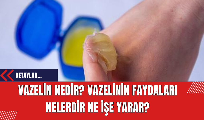 Vazelin Nedir? Vazelinin Faydaları Nelerdir Ne İşe Yarar?