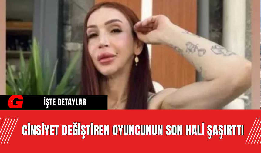 Cinsiyet Değiştiren Oyuncunun Son Hali Şaşırttı