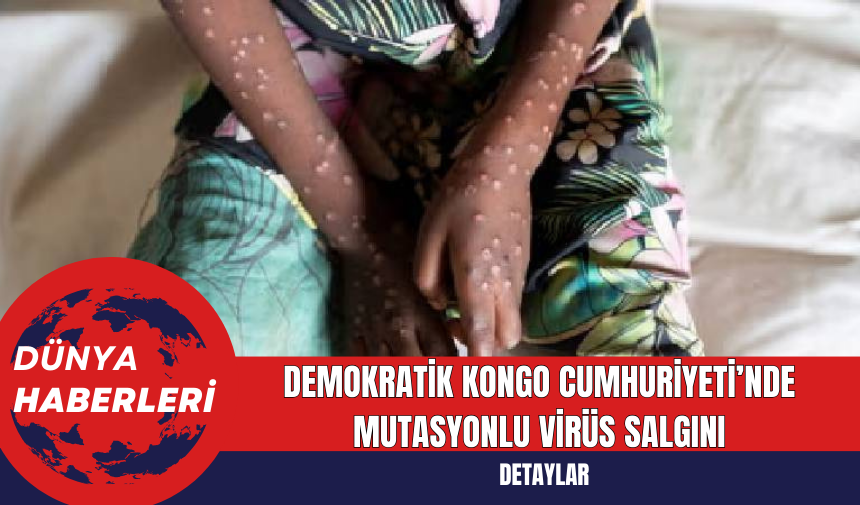 Demokratik Kongo Cumhuriyeti’nde Mutasyonlu Virüs Salgını