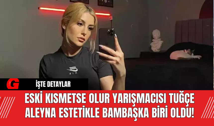 Eski Kısmetse Olur Yarışmacısı Tuğçe Aleyna Estetikle Bambaşka Biri Oldu!