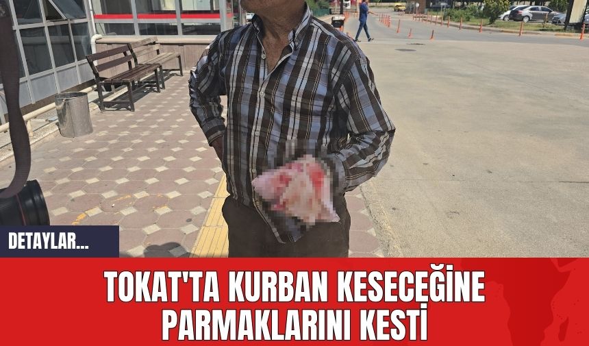 Tokat'ta Kurban Keseceğine Parmaklarını Kesti