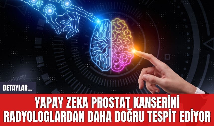 Yapay Zeka Prostat Kanserini Radyologlardan Daha Doğru Tespit Ediyor