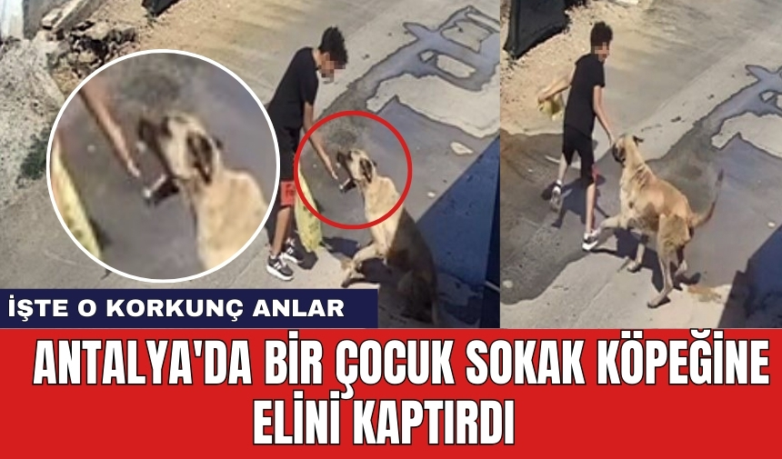 Antalya'da bir çocuk sokak köpeğine elini kaptırdı