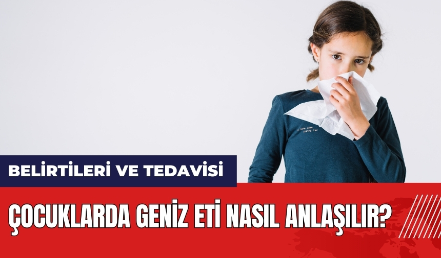 Çocuklarda geniz eti nasıl anlaşılır? Geniz eti büyümesi belirtileri ve tedavisi