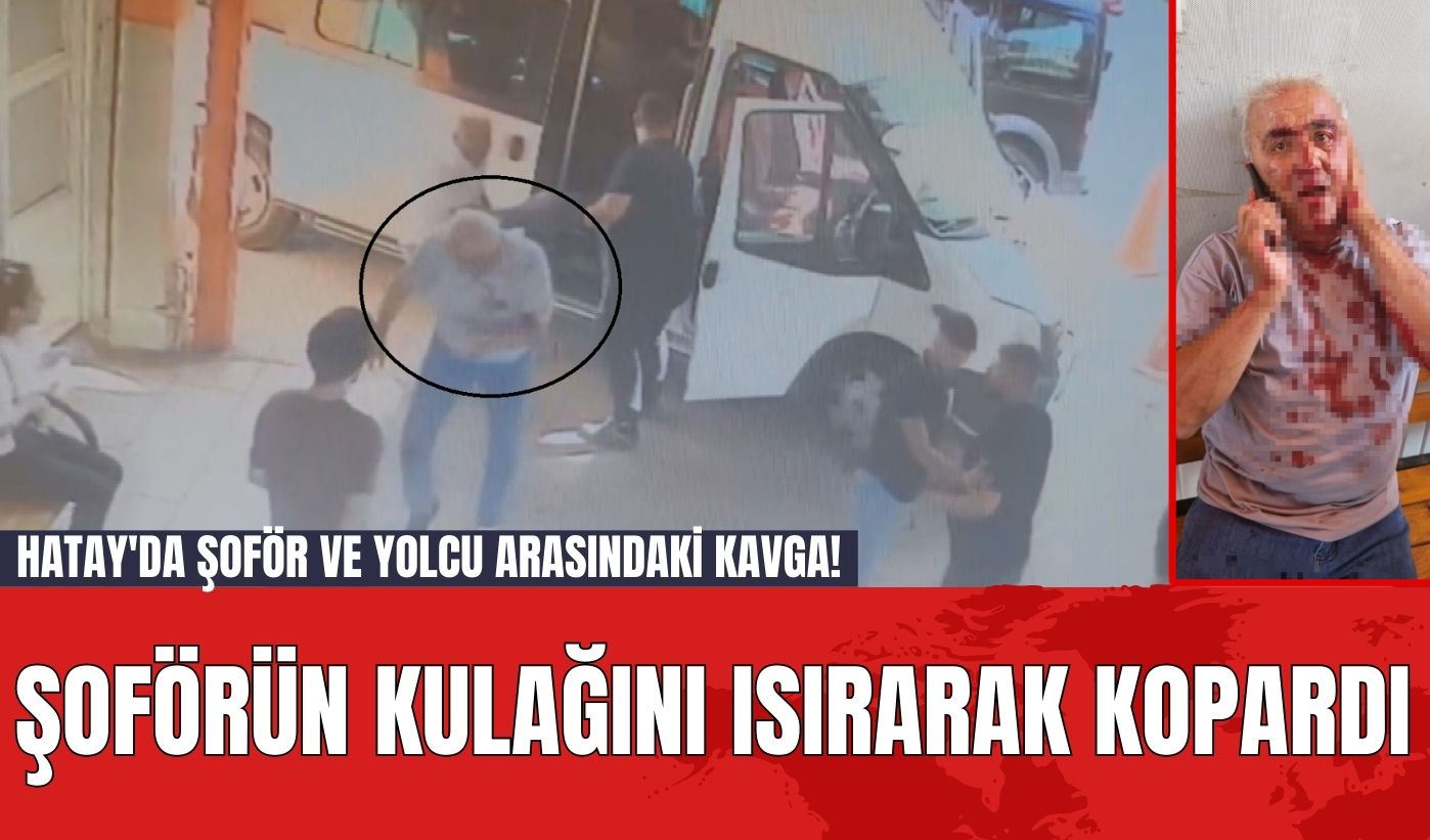 Hatay'da Şoför ve Yolcu Arasındaki Kavga! Şoförün Kulağını Isırarak Kopardı