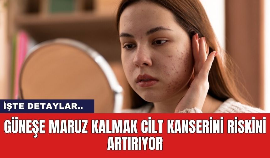 Güneşe maruz kalmak cilt kanserini riskini artırıyor