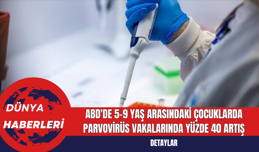 ABD'de 5-9 Yaş Arasındaki Çocuklarda Parvovirüs Vakalarında Yüzde 40 Artış