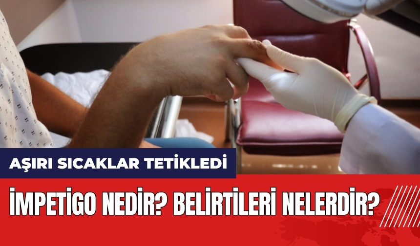 Aşırı sıcaklar cilt hastalıklarını tetikledi! İmpetigo nedir? Belirtileri nelerdir?