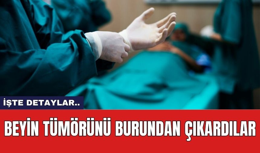 Beyin Tümörünü Burundan Çıkardılar