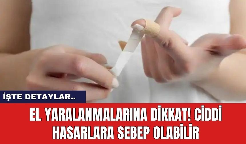 El Yaralanmalarına Dikkat! Ciddi Hasarlara Sebep Olabilir