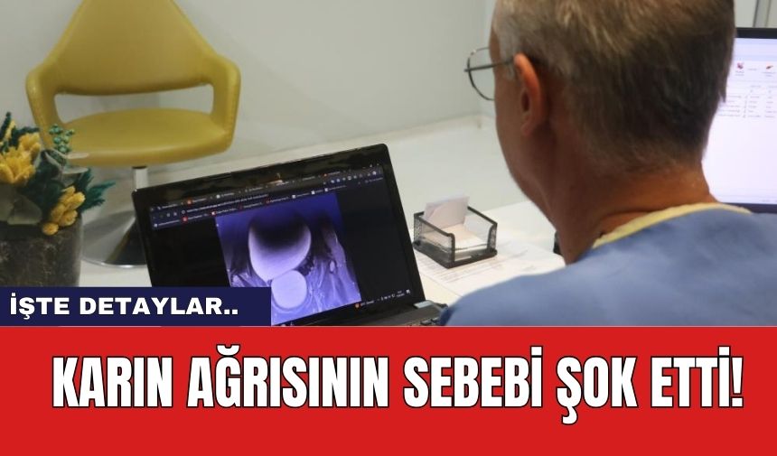 Karın Ağrısının Sebebi Şok Etti!