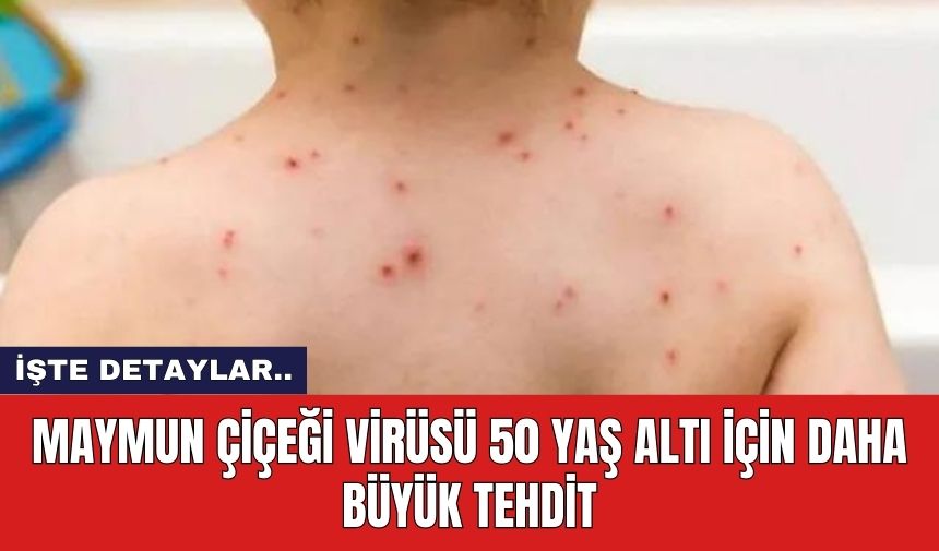 Maymun çiçeği virüsü 50 yaş altı için daha büyük tehdit