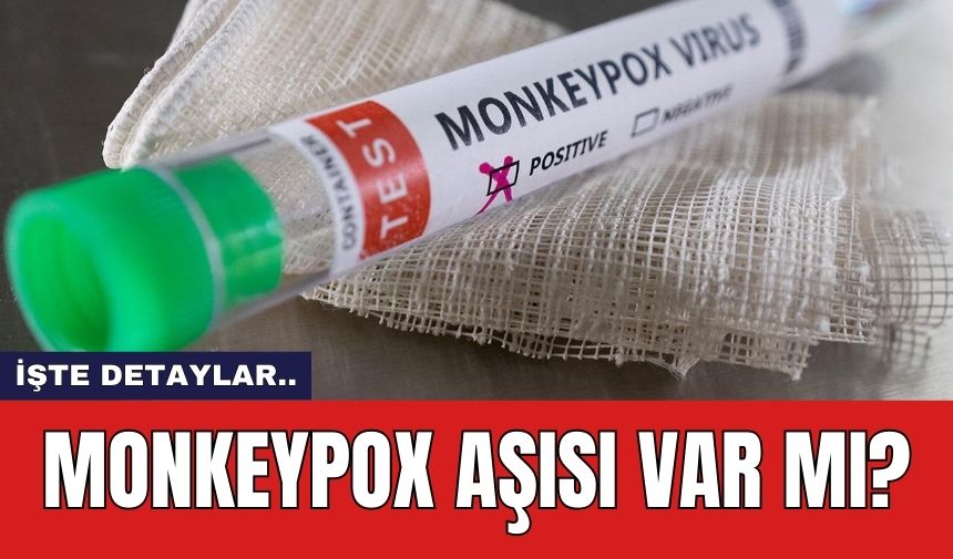 Monkeypox aşısı var mı?