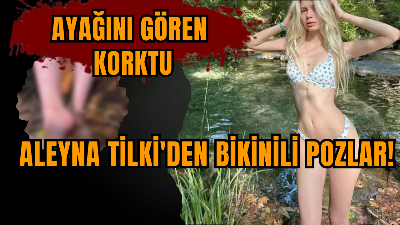 Aleyna Tilki'den bikinili pozlar! Ayağını gören korktu