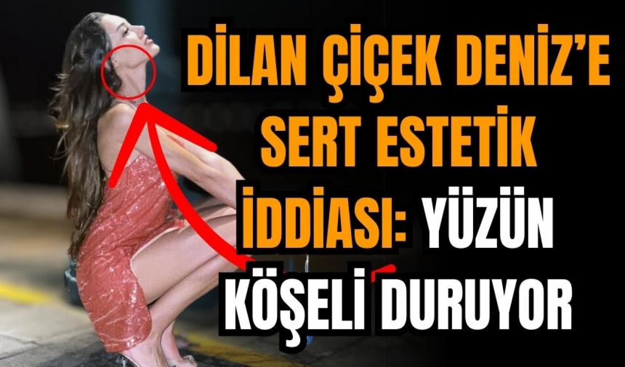 Dilan Çiçek Deniz'e estetik iddiası: Yüzün köşeli duruyor