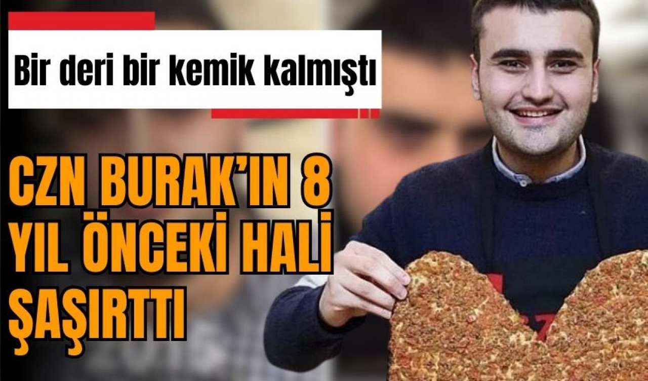 İğne ipliğe dönen CZN Burak 8 yıl önceki halini paylaştı